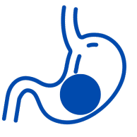 Balón Intragástrico