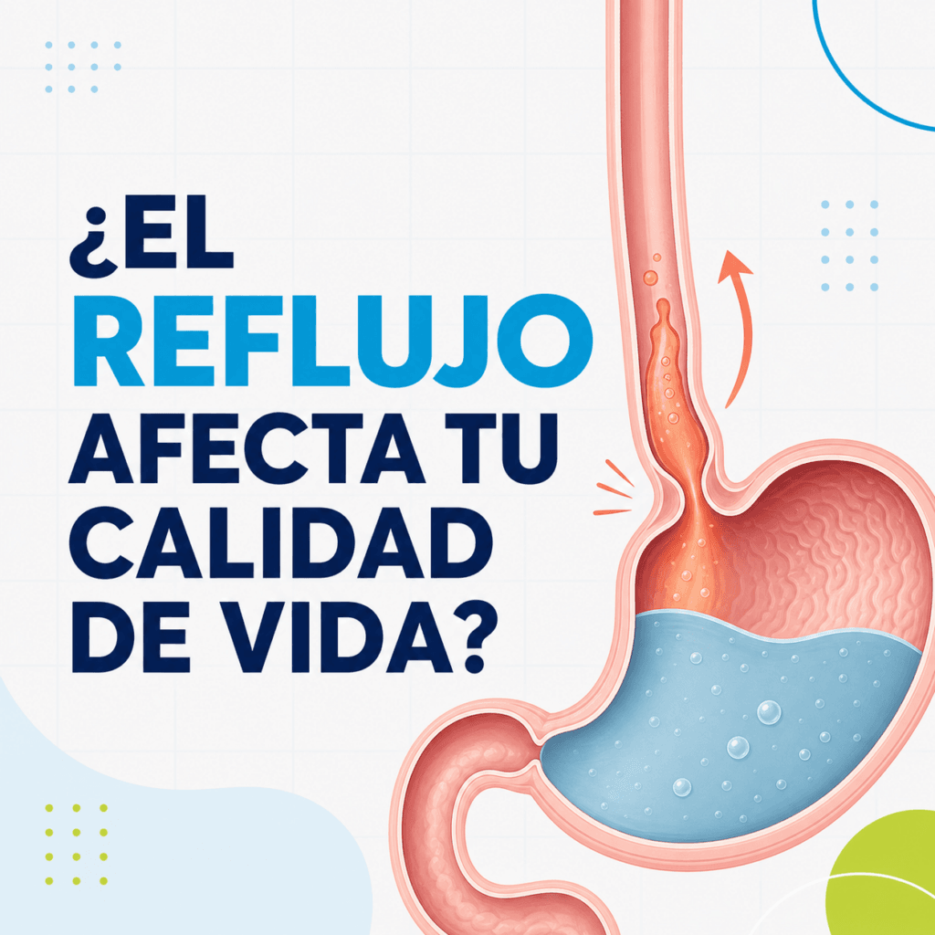 Ilustración del reflujo gastroesofágico y su impacto en la calidad de vida